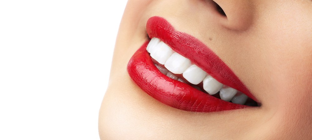 What is a Hollywood smile or a Hollywood smile?